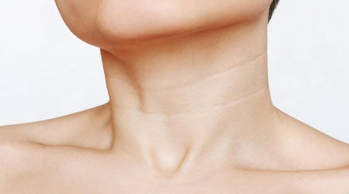 6 Most Effective Neck Line and Wrinkles Removal Treatments